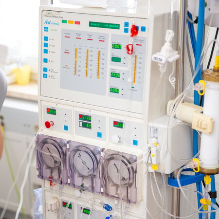 Ein aktives Dialysegerät mit digitaler Anzeige, transparenter Filtrationseinheit und angeschlossenen Schlauchsystemen steht in einem hellen Behandlungsraum. Farbige Knöpfe und Kabel unterstützen die visuelle Kontrolle. Die Szene vermittelt klinische Präzi