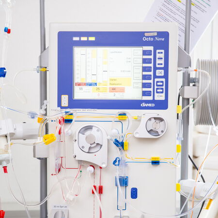Ein aktives Dialysegerät mit digitaler Anzeige, transparenter Filtrationseinheit und angeschlossenen Schlauchsystemen steht in einem hellen Behandlungsraum. Farbige Knöpfe und Kabel unterstützen die visuelle Kontrolle. Die Szene vermittelt klinische Präzi